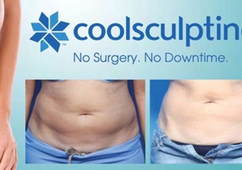 All you need to know about CoolSculpting